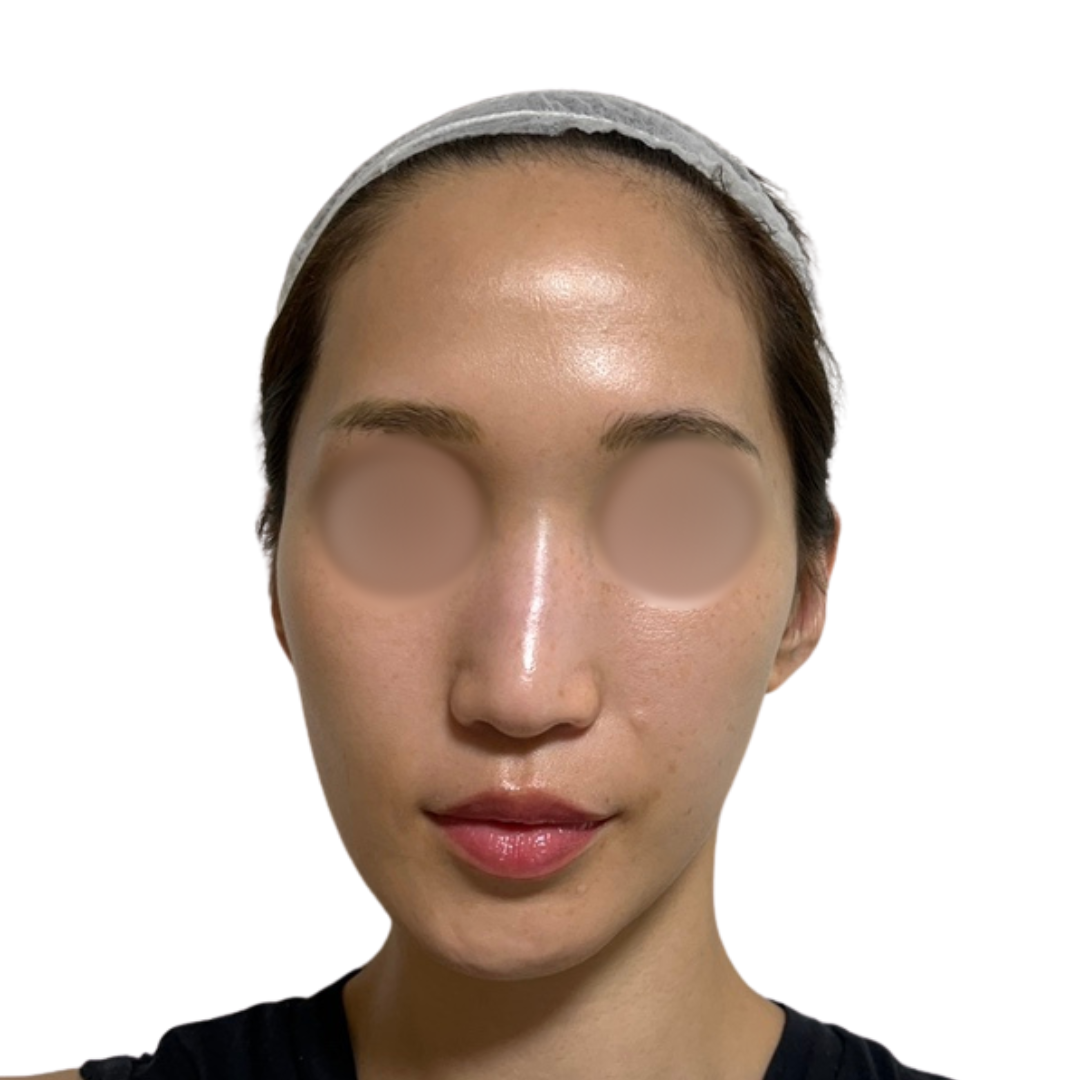 パーティーリフト（スマスアップネオ）